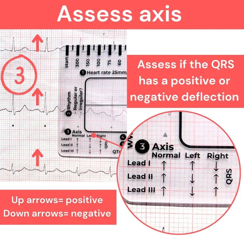 CardioScale™ - ECG 7 Step Ruler