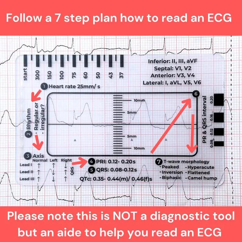 CardioScale™ - ECG 7 Step Ruler