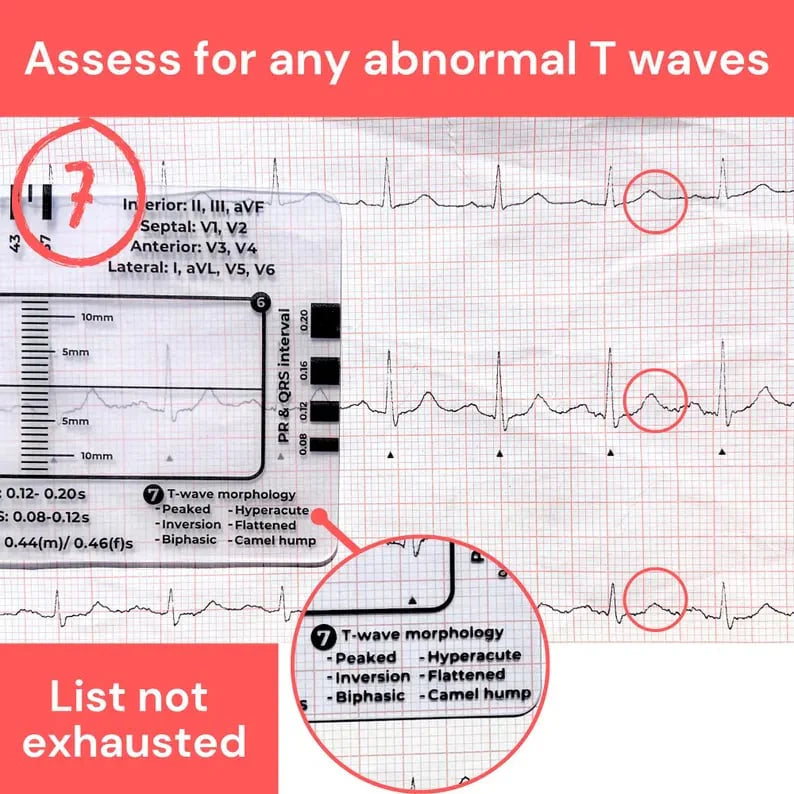 CardioScale™ - ECG 7 Step Ruler