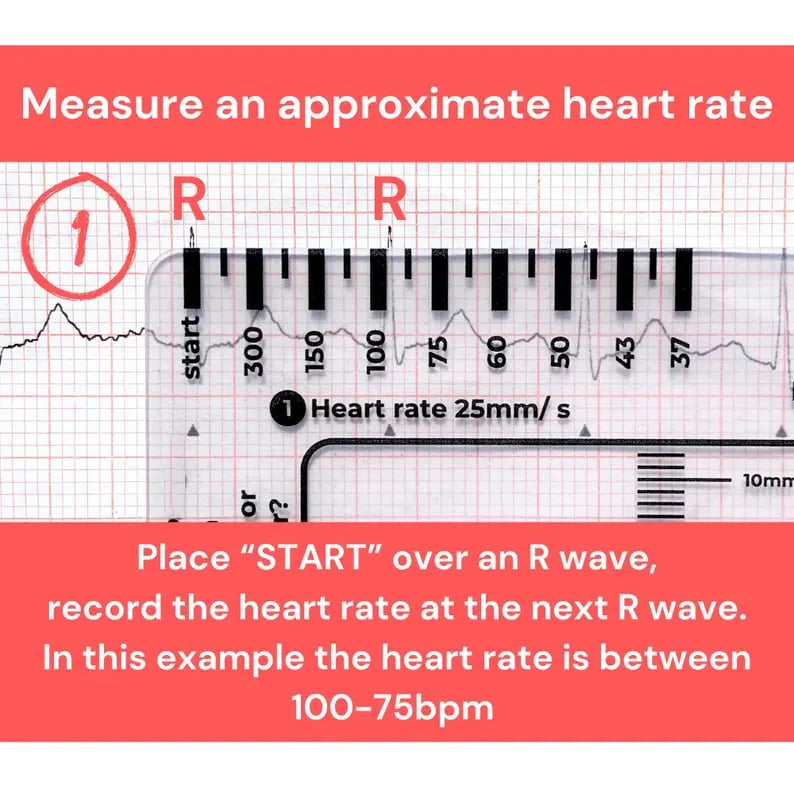 CardioScale™ - ECG 7 Step Ruler