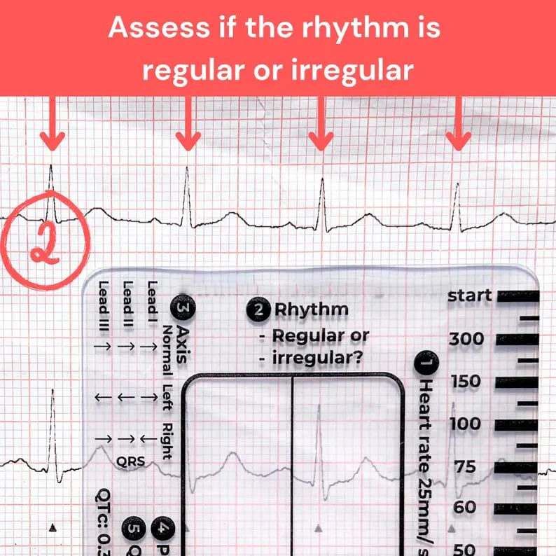 CardioScale™ - ECG 7 Step Ruler