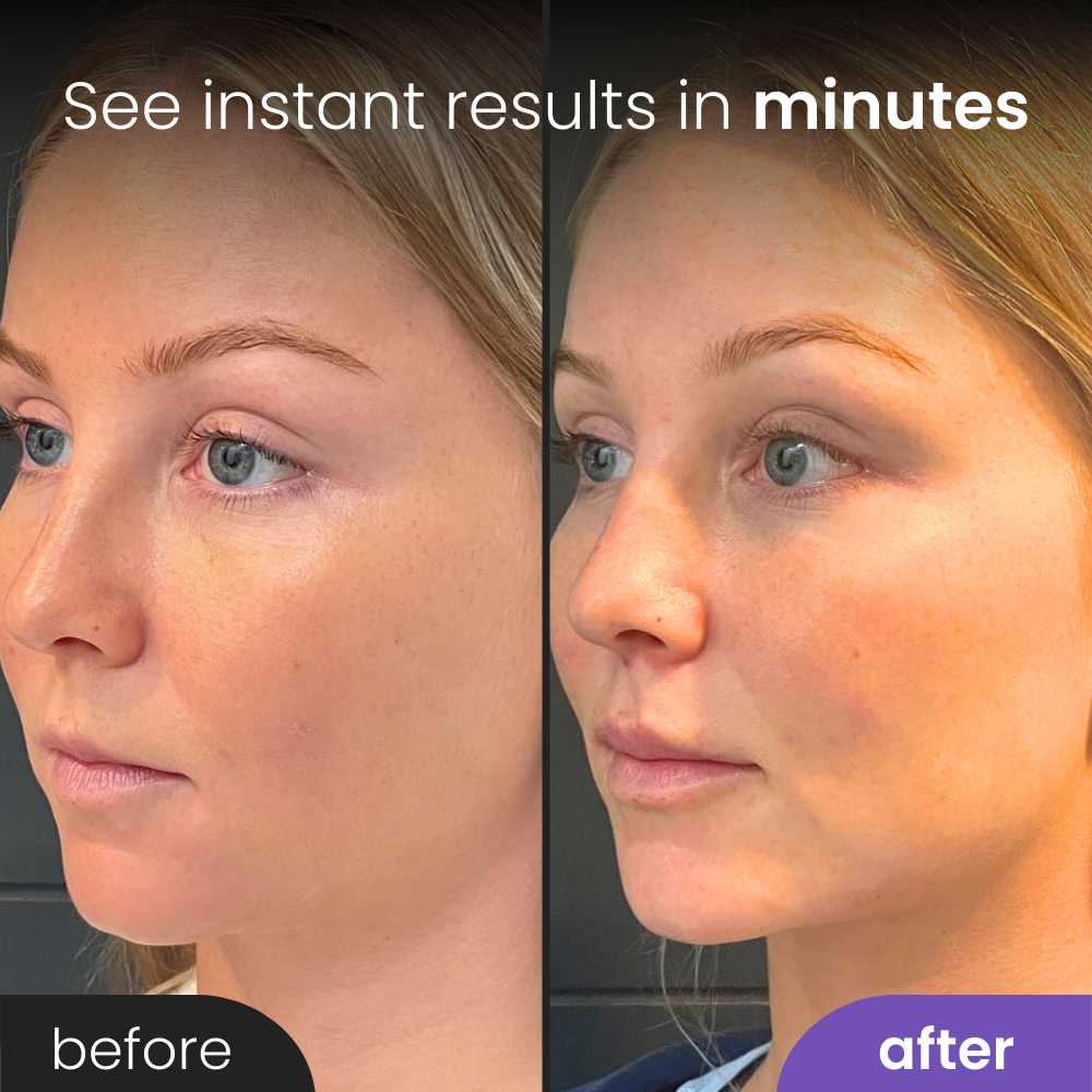 VitaRoll™ - Beauty Sculptor