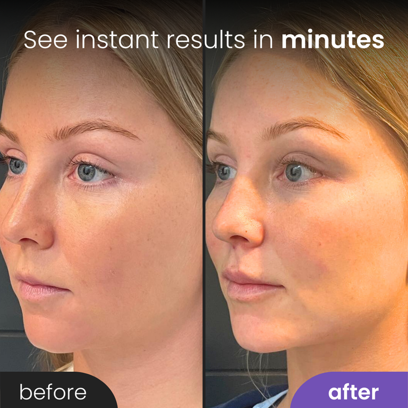 VitaRoll™ - Beauty Sculptor