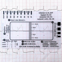 CardioScale™ - ECG 7 Step Ruler