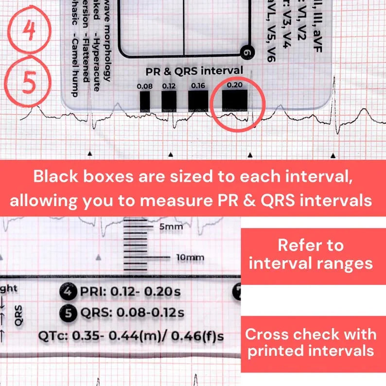 CardioScale™ - ECG 7 Step Ruler